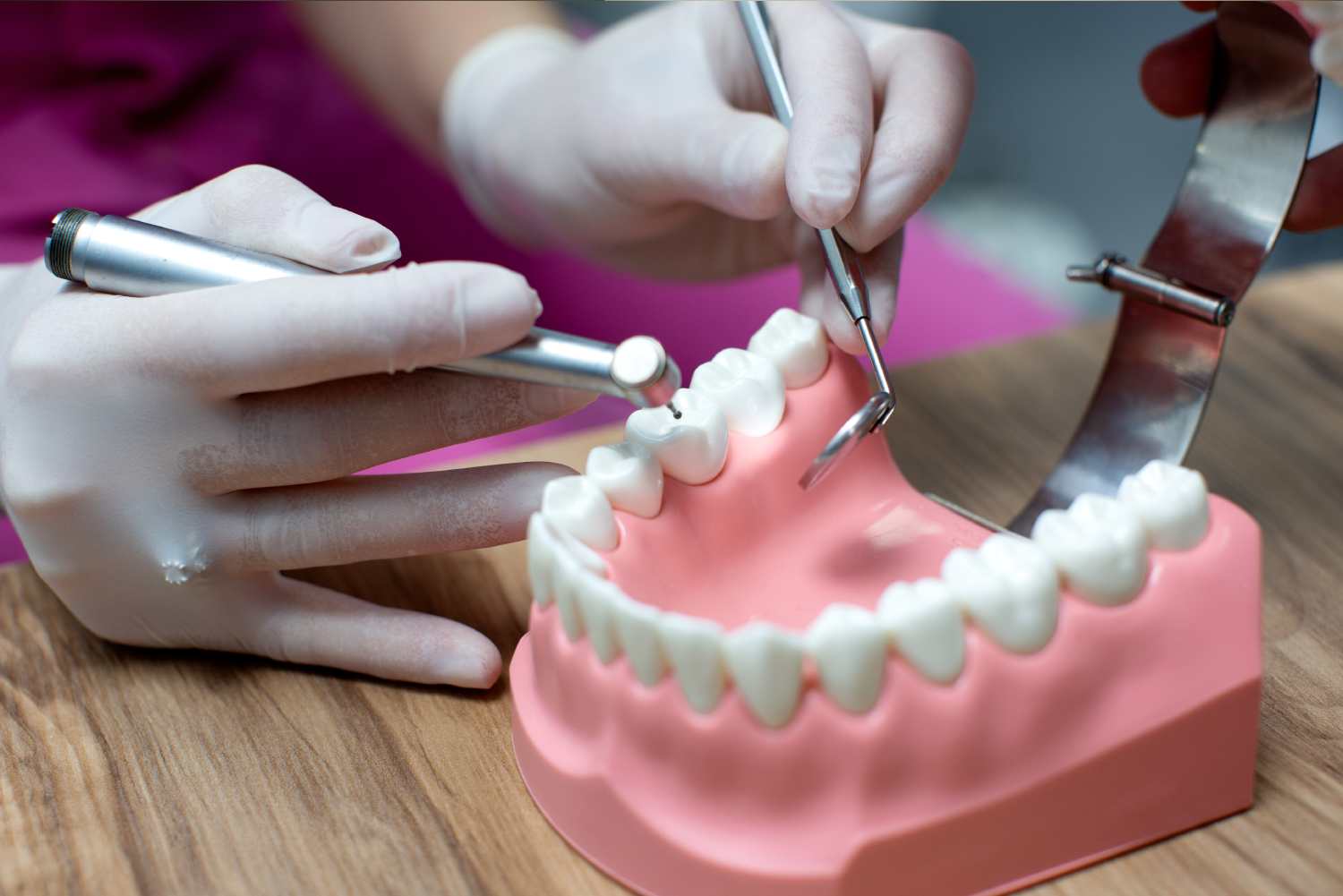 Dental Implants vs Dentures